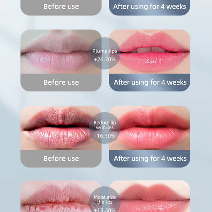 Dental Light Therapy