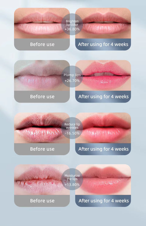 Dental Light Therapy